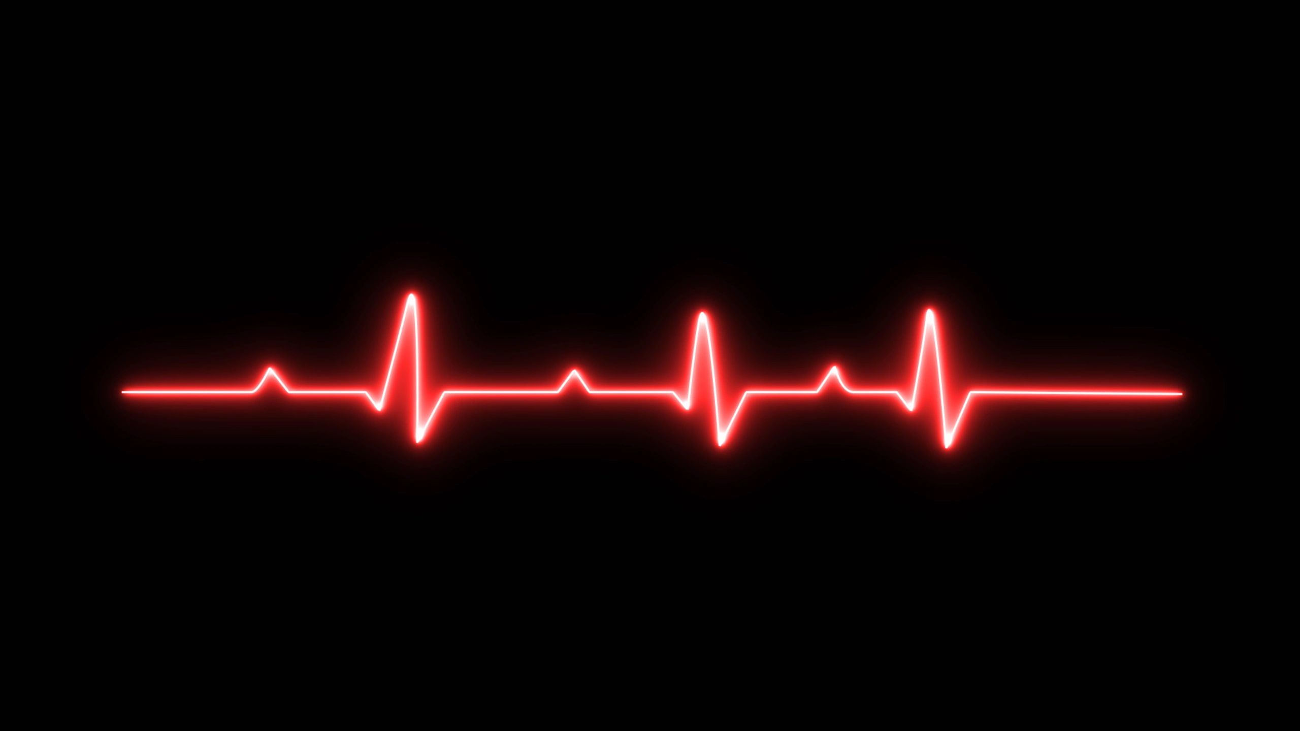 EKG waveform